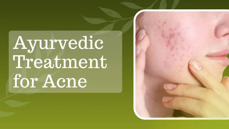 Ayurvedic Treatment for Acne